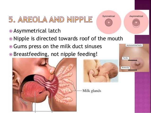 White Nipples After Breastfeeding